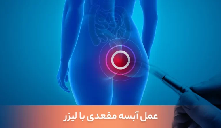 لیزر آبسه مقعدی