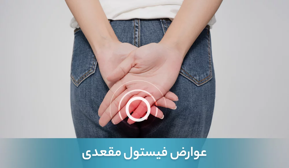 عوارض فیستول مقعدی