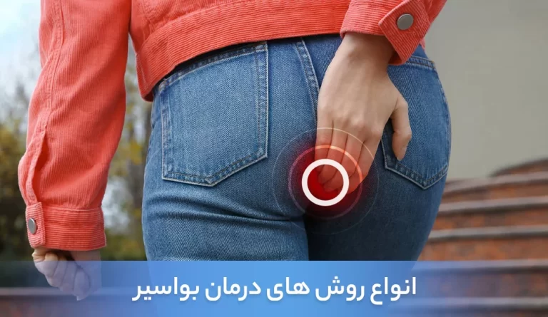 انواع روش های درمان بواسیر -درمان بواسیر -درمان بواسیر یا هموروئید -درمان هموروئید