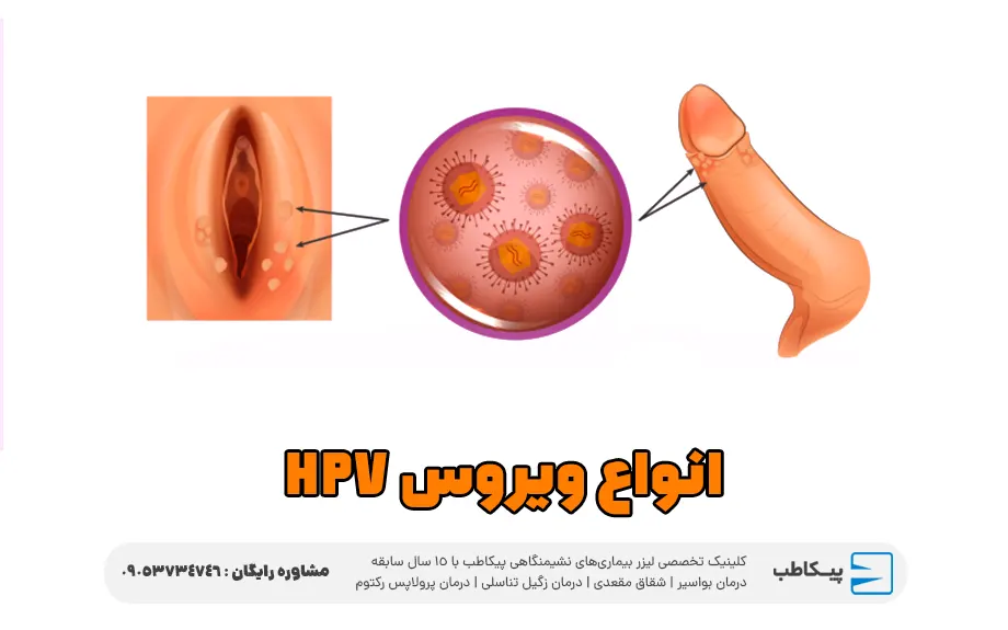 انواع ویروس HPV