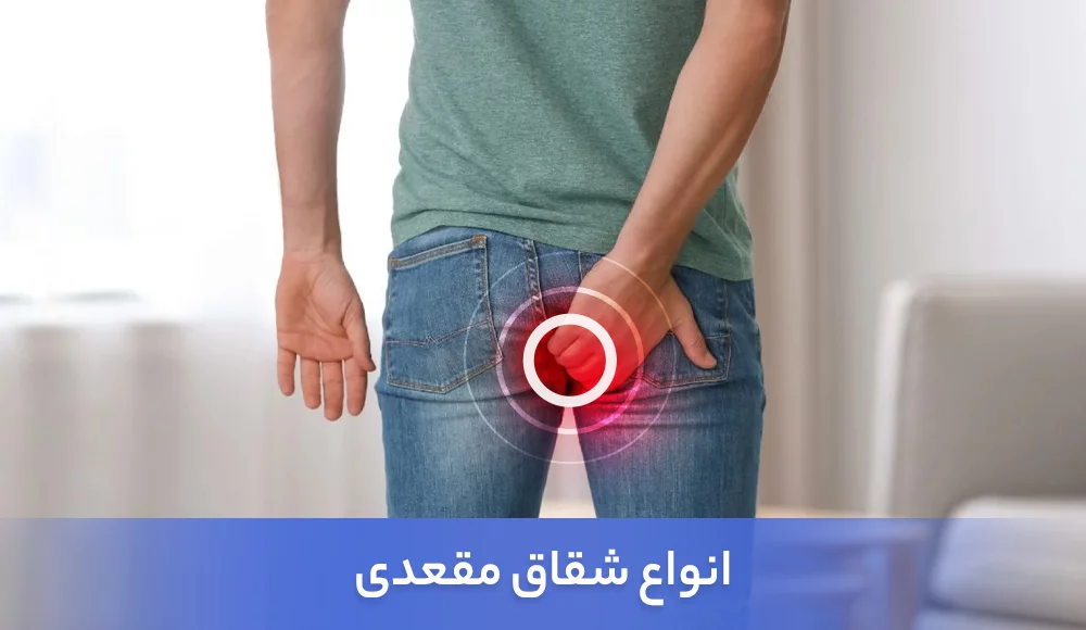 انواع شقاق مقعدی