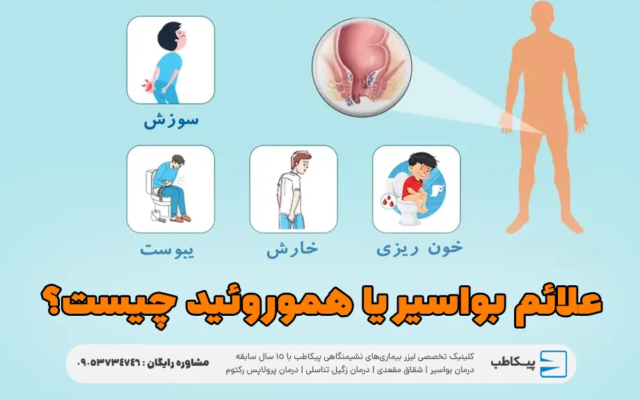 علائم بواسیر یا هموروئید چیست؟