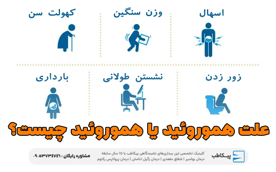 علت وجود هموروئید یا بواسیر چیست