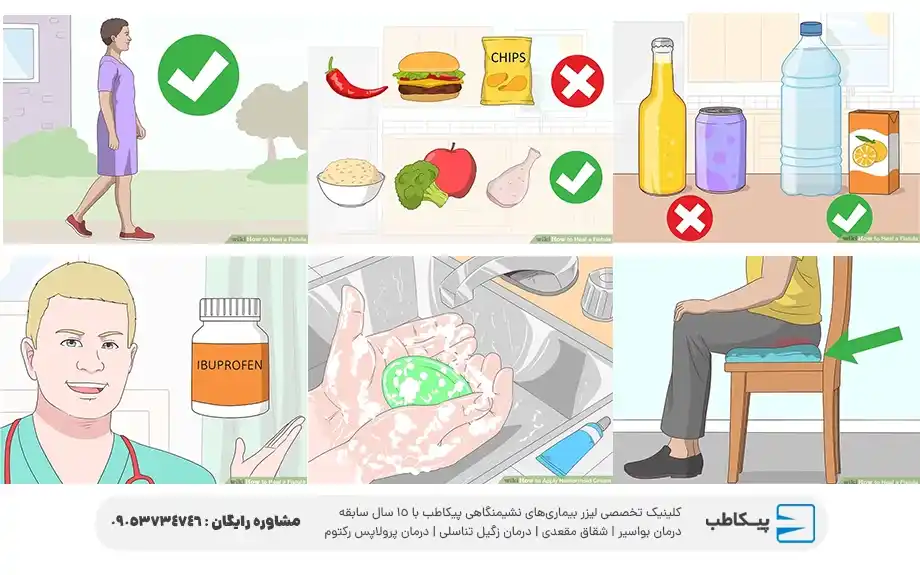 پیشگیری از فیستول مقعدی در مردان