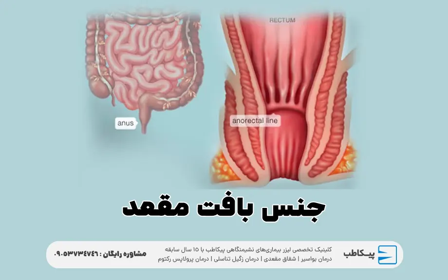 جنس بافت مقعد