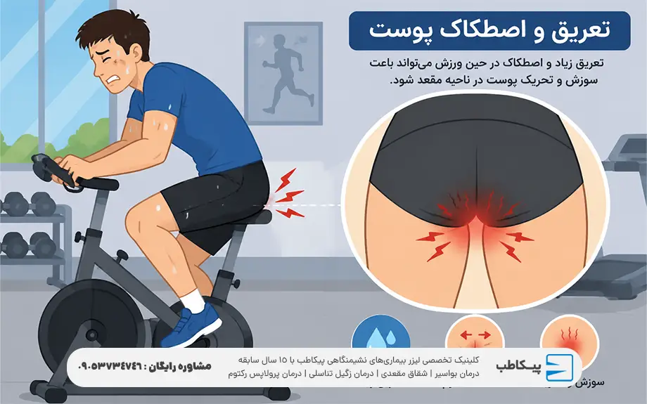 جوش مقعدی چیست؟ علائم،علت،درمان 3 جوش مقعدی در اثر تعریق پوست