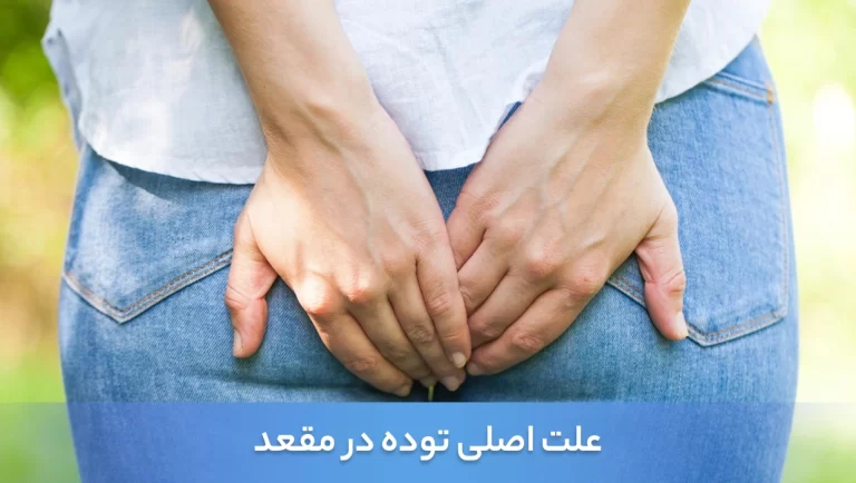 توده در مقعد