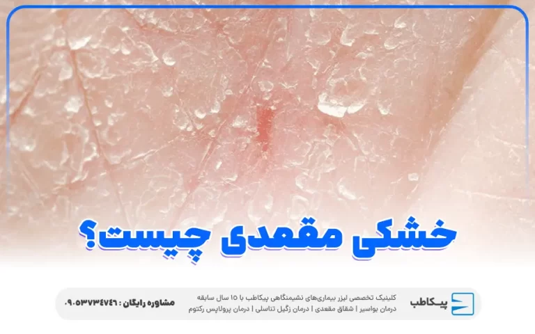 خشکی مقعدی چیست و چگونه درمان می شود