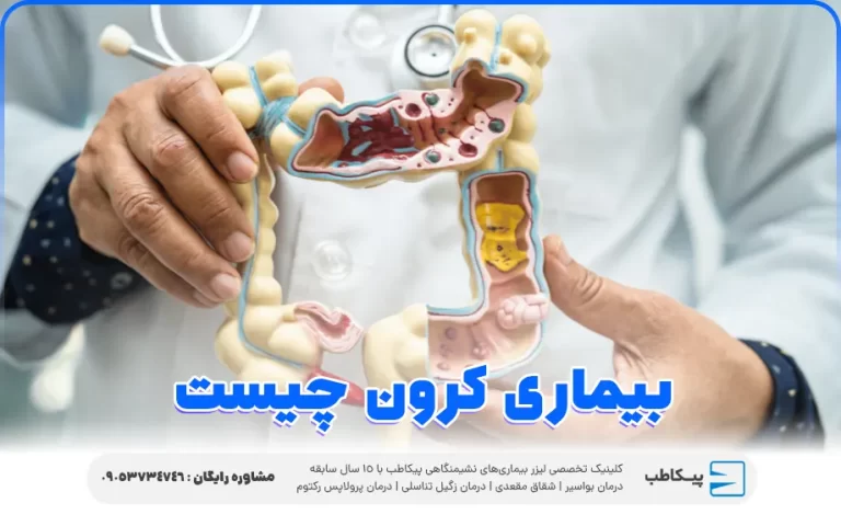 بیماری کرون چیست {کرون خطرناکه} + تشخیص علائم، داروها و عکس