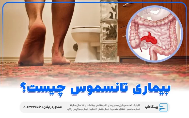 راهنمای جامع بیماری تنسموس | پیشگیری و درمان