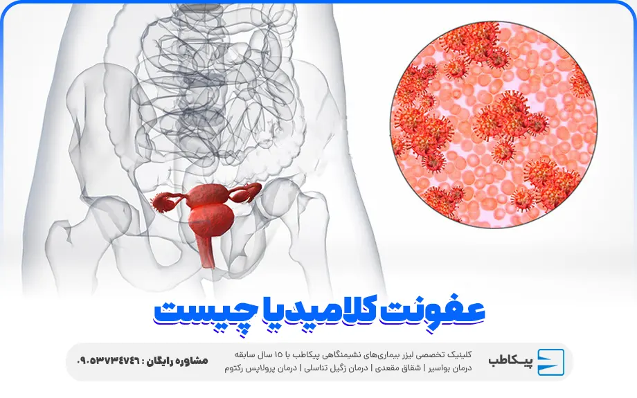 عفونت کلامیدیا | علائم زنان و مردان + درمان خانگی و دارویی